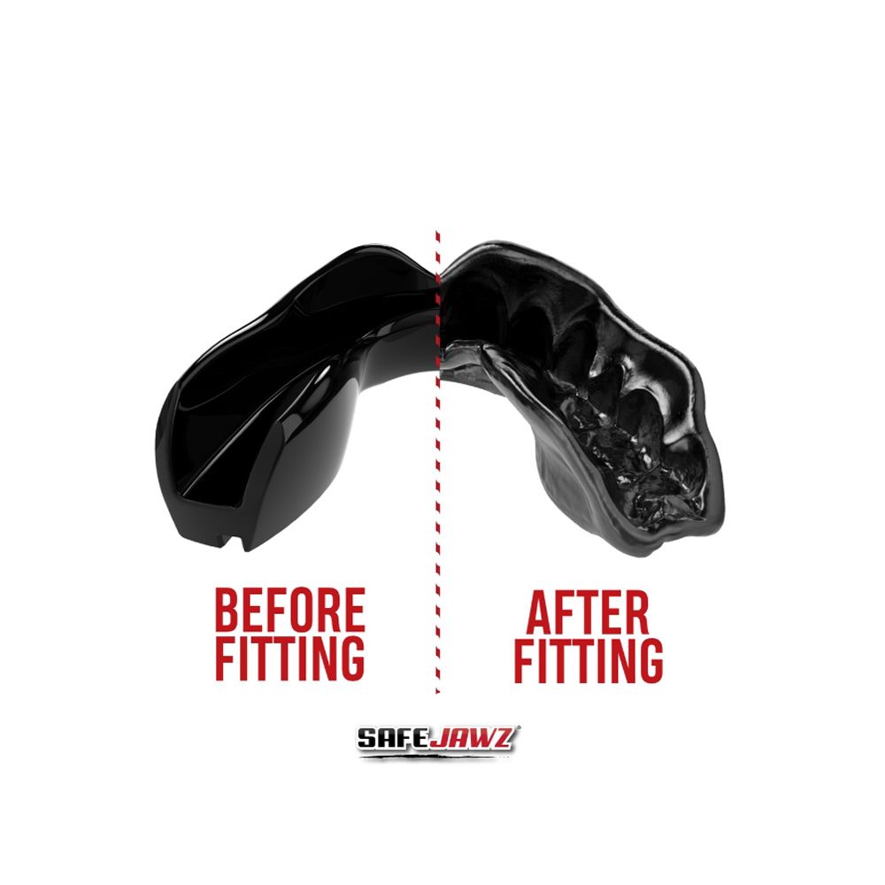 SAFEJAWZ - MOUNTHGUARD - SAFEJAWZ INTRO BLACK