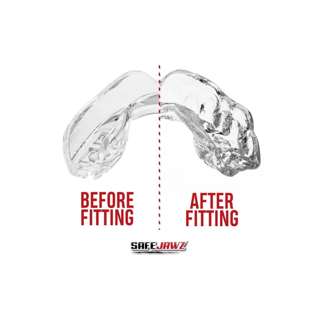 SAFEJAWZ - MOUNTHGUARD - SAFEJAWZ INTRO CLEAR