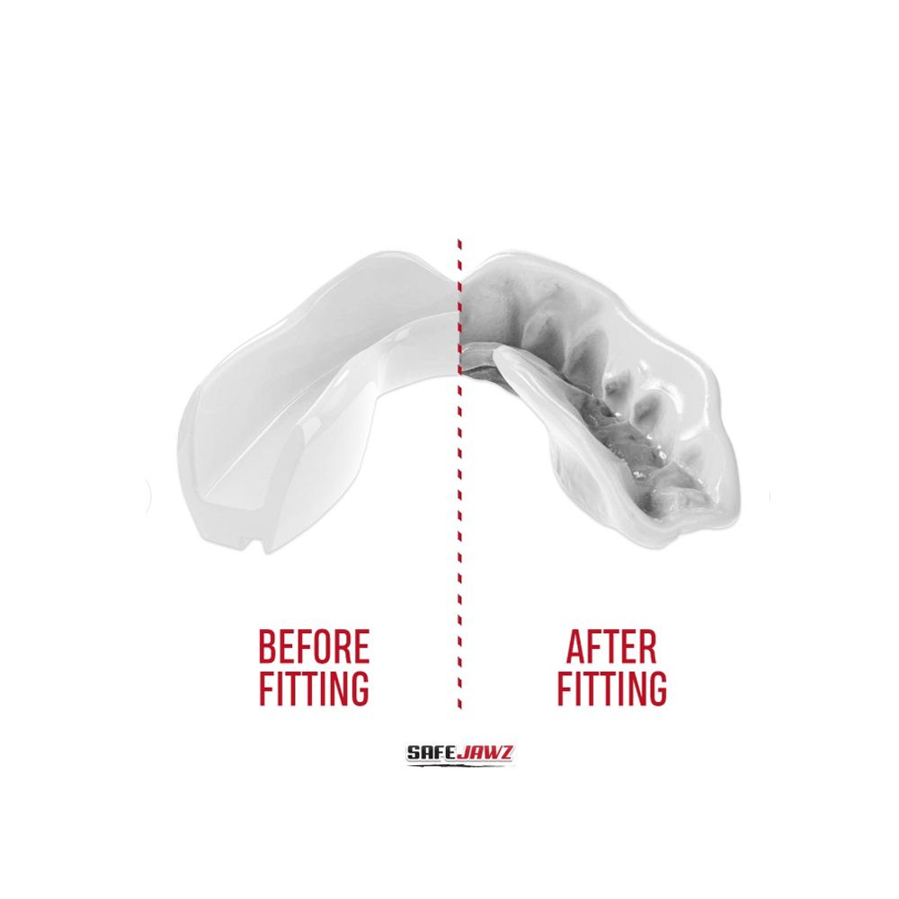 SAFEJAWZ - MOUNTHGUARD - SAFEJAWZ INTRO WHITE